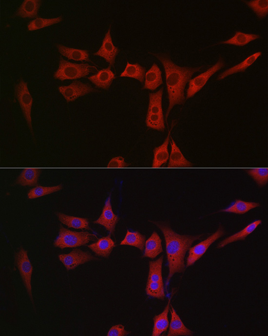a04413 msra primary antiboties if testing 3