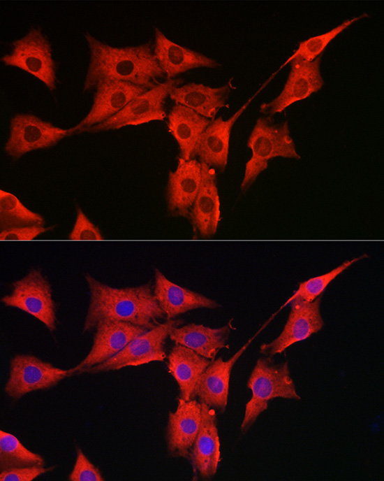 a04413 msra primary antiboties if testing 4