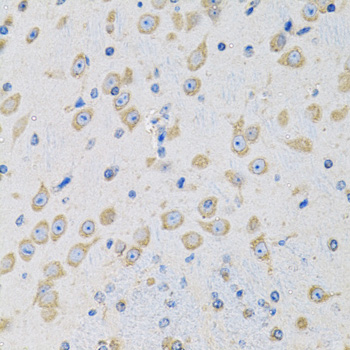 a04413 msra primary antiboties ihc testing 2