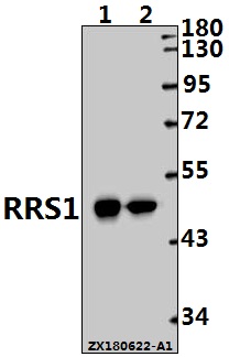 Western blot (WB) analysis of RRS1 (R286) pAb at 1:1000 dilution
Lane1:EC9706 whole cell lysate(10ug)
Lane2:A375 whole cell lysate(10ug)