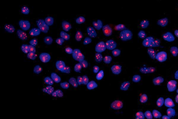 a04418 3 rrs1 primary antibodies if testing 7