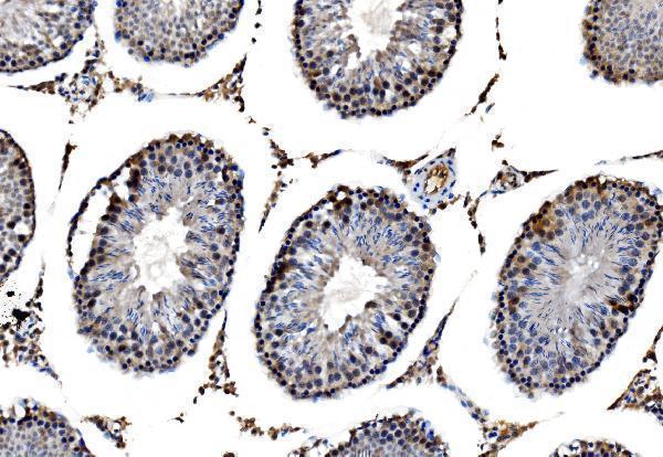  IHC analysis of RRS1 using anti-RRS1 antibody (A04418-3)