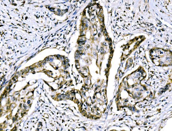 IHC analysis of RRS1 using anti-RRS1 antibody (A04418-3)