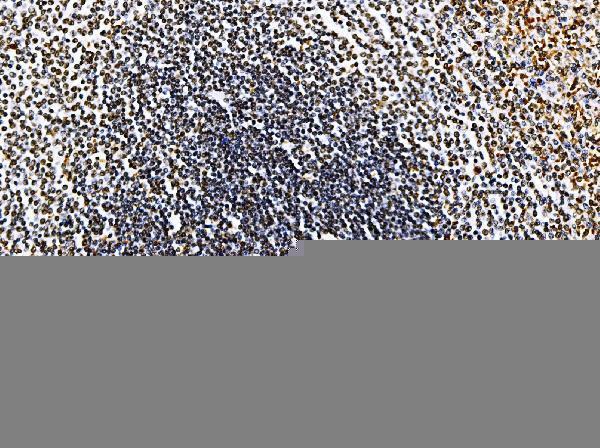 a04418 3 rrs1 primary antibodies ihc testing 4