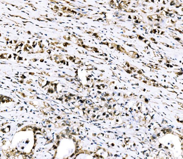 a04418 3 rrs1 primary antibodies ihc testing 5