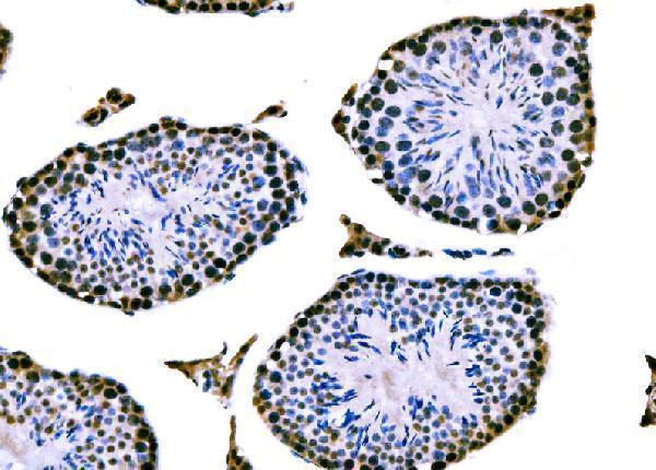 a04418 3 rrs1 primary antibodies ihc testing 6