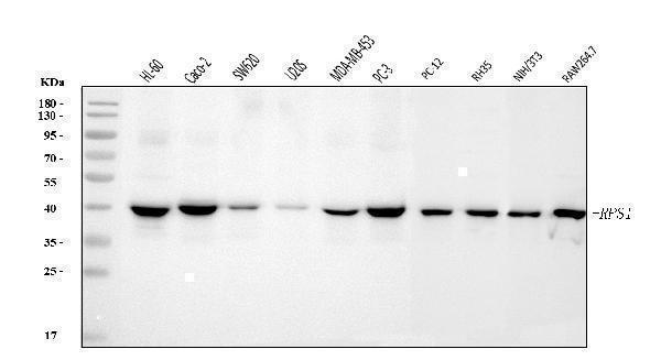  Western blot analysis of RRS1 using anti-RRS1 antibody (A04418-3)