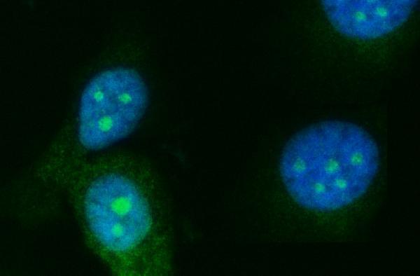 a04418 4 rrs1 primary antibodies if testing 7