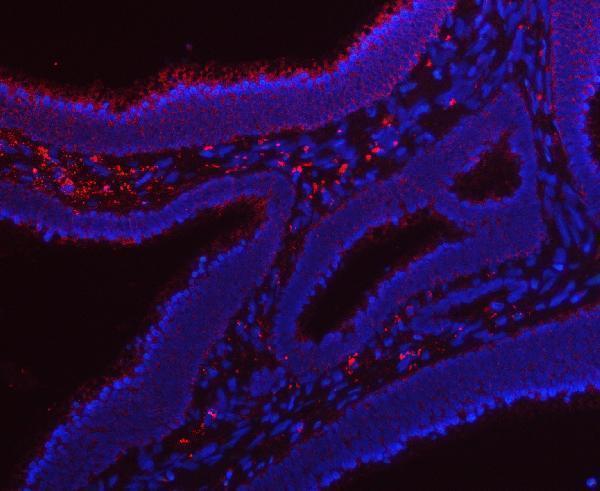 a04418 4 rrs1 primary antibodies if testing 8