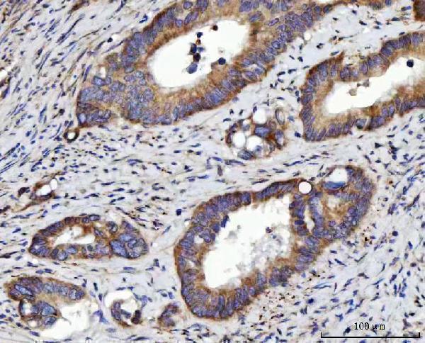  IHC analysis of RRS1 using anti-RRS1 antibody (A04418-4)