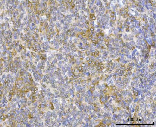  IHC analysis of RRS1 using anti-RRS1 antibody (A04418-4)