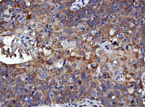 a04418 4 rrs1 primary antibodies ihc testing 4