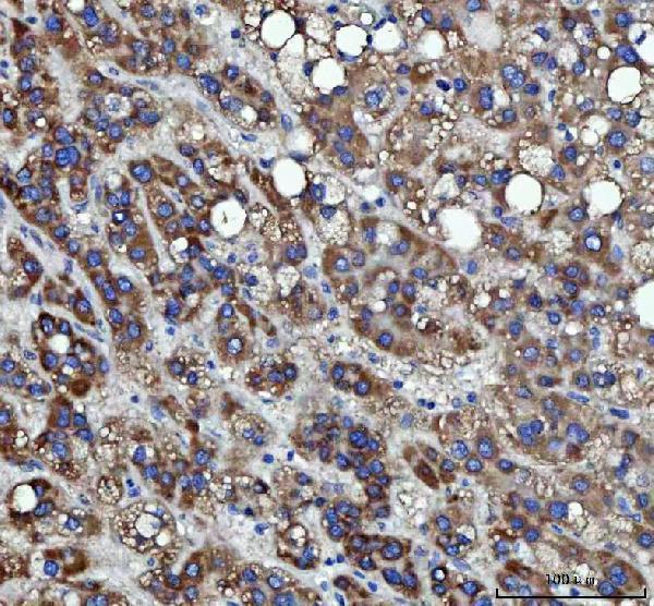 a04418 4 rrs1 primary antibodies ihc testing 5