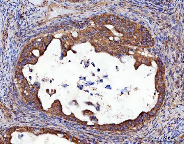 a04418 4 rrs1 primary antibodies ihc testing 6