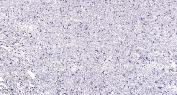 a04418 rrs1 primary antibodies ihc testing 1