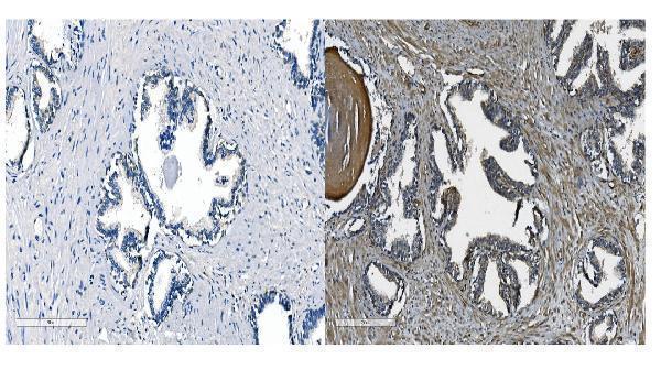  IHC analysis of OB Cadherin/CDH11 using anti-OB Cadherin/CDH11 antibody (A04419-1)