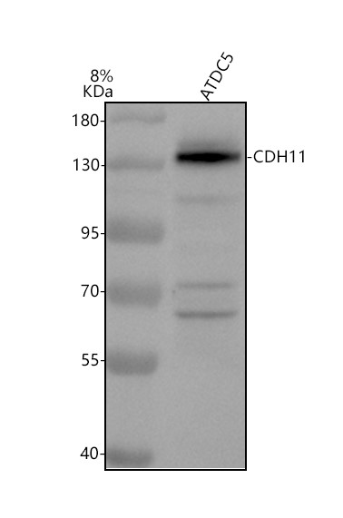 Western blot analysis of CDH11 using anti-CDH11 antibody (A04419-1)