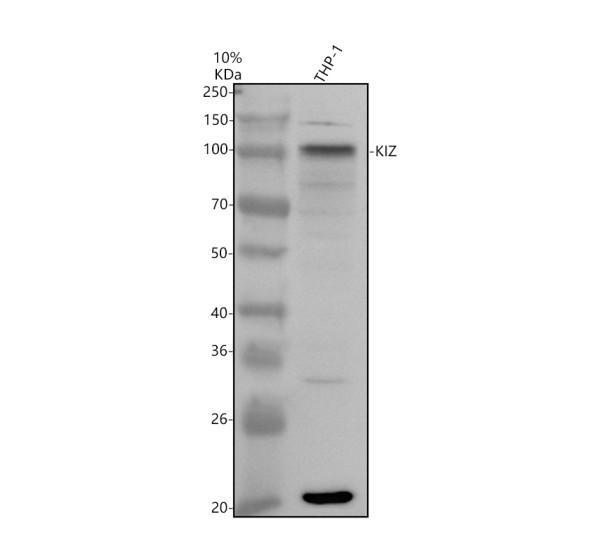 Western blot analysis of KIZ using anti-KIZ antibody (A04420-1)