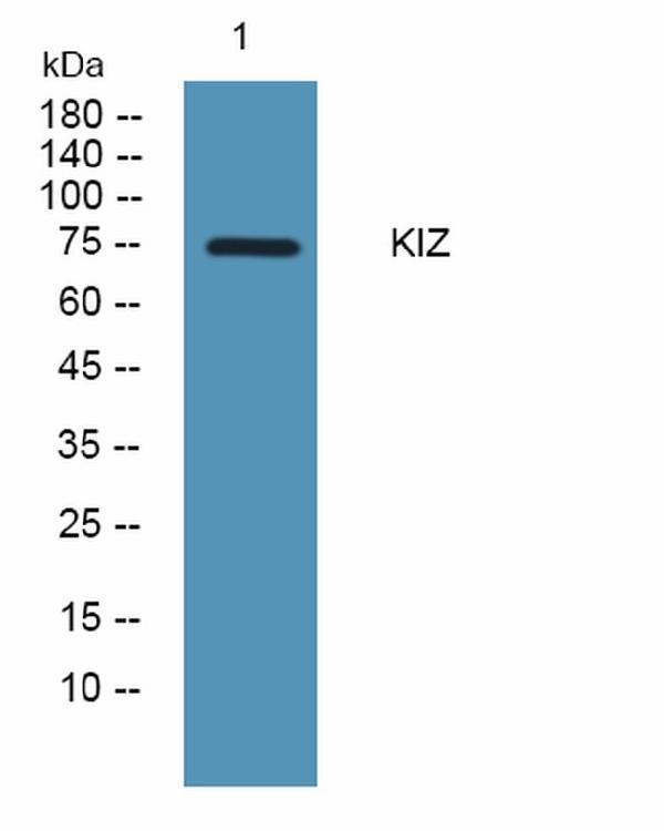 Western blot analysis of lysates from KB cells, primary antibody was diluted at 1:1000, 4°C over night