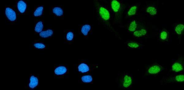 a04421 1 pola1 primary antibodies if testing 2
