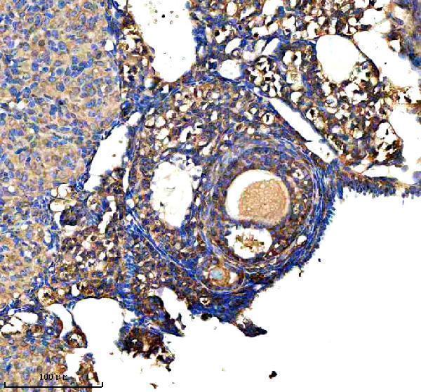  IHC analysis of GSTM2 using anti-GSTM2 antibody (A04423-3)