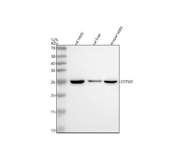 Western blot analysis of GSTM2 using anti-GSTM2 antibody (A04423-3)