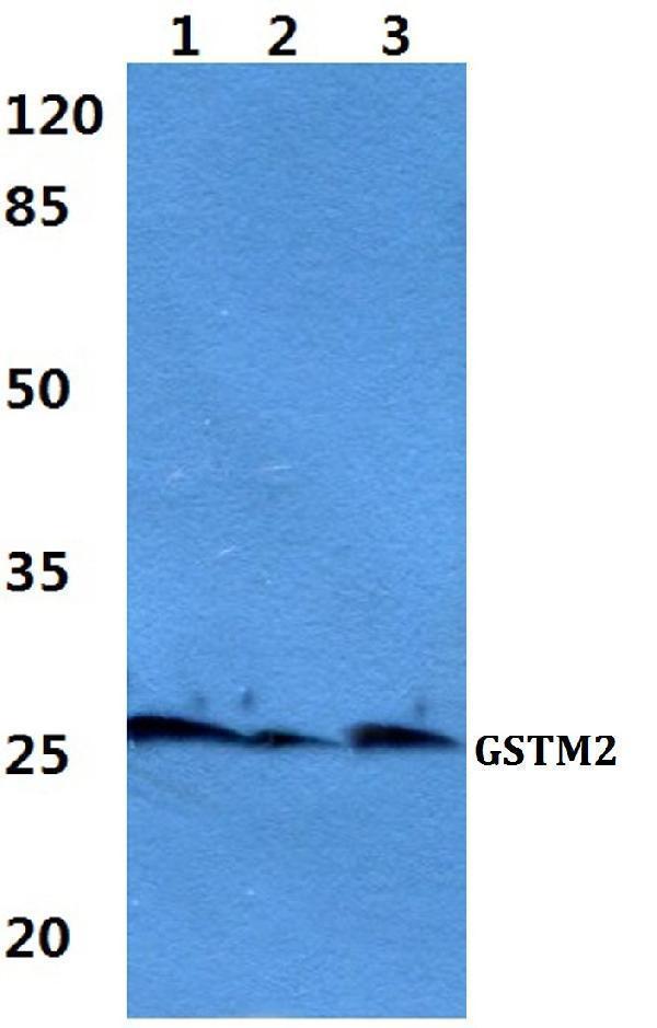 Western blot (WB) analysis of GSTM2 polyclonal antibody at 1:500 dilution
Lane1:Hela cell lysate
Lane2:Mouse liver tissue lysate
Lane3:Rat liver tissue lysate