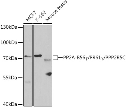 a04424 ppp2r5c primary antiboties wb testing 1