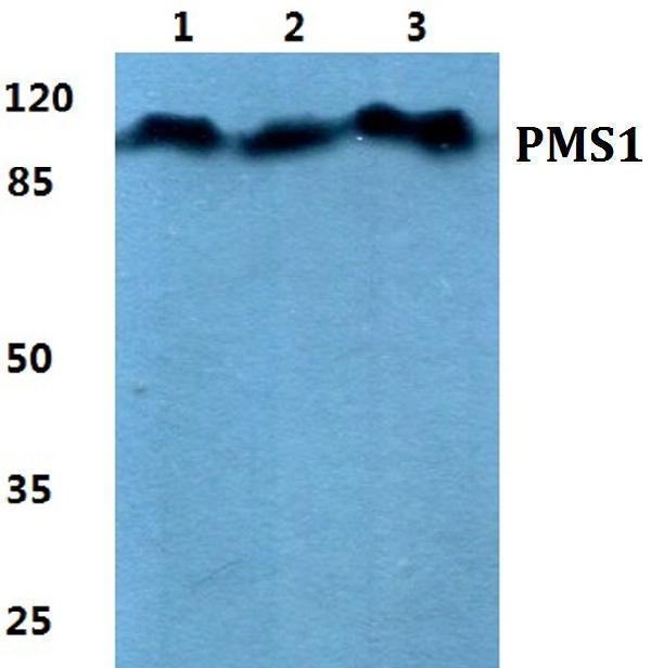 Western blot (WB) analysis of PMS1 polyclonal antibody at 1:500 dilution
Lane1:Hela cell lysate
Lane2:Raw264