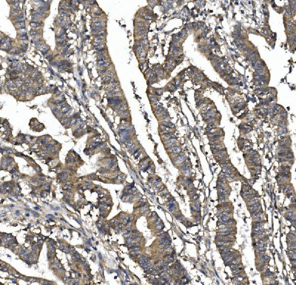a04426 3 sorbs1 primary antibodies ihc testing 2
