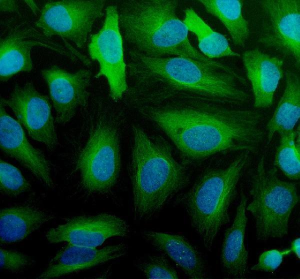 a04428 1 ifit2 primary antibodies if testing 1