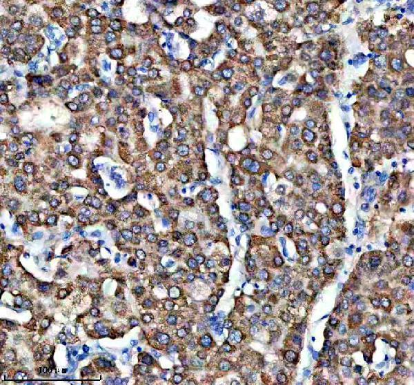 IHC analysis of IFIT2 using anti-IFIT2 antibody (A04428-1)