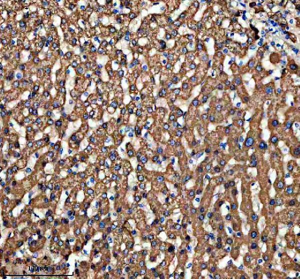 IHC analysis of IFIT2 using anti-IFIT2 antibody (A04428-1)