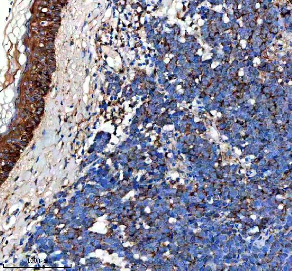 a04428 1 ifit2 primary antibodies ihc testing 3