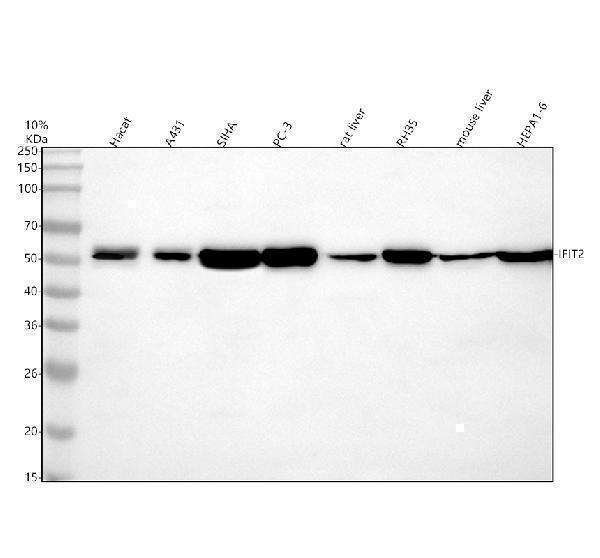 Western blot analysis of IFIT2 using anti-IFIT2 antibody (A04428-1)