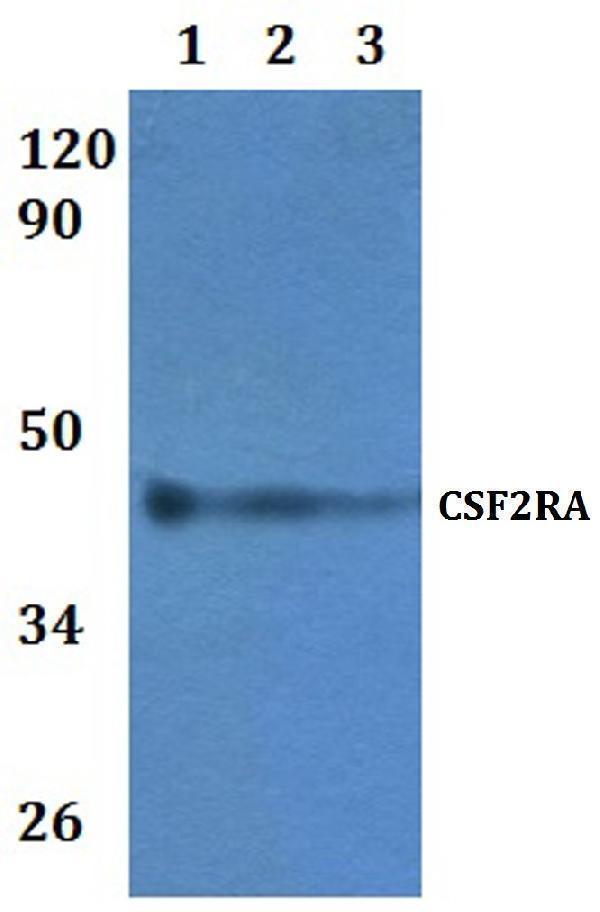 a04432 2 csf2ra primary antiboties wb testing 1