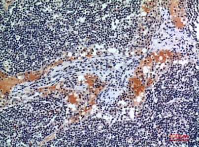 a04432 csf2ra primary antibodies ihc testing 1