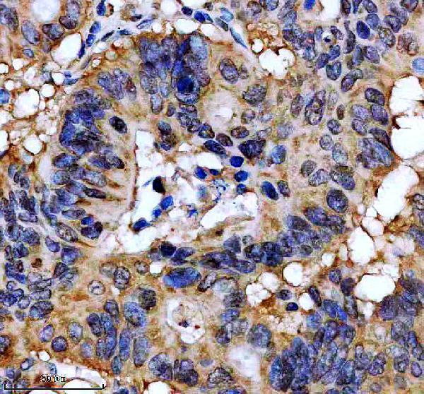 IHC analysis of DRG1 using anti-DRG1 antibody (A04435-1)