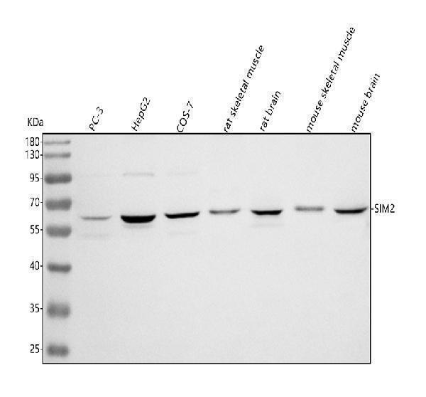  Western blot analysis of SIM2 using anti-SIM2 antibody (A04436-2)