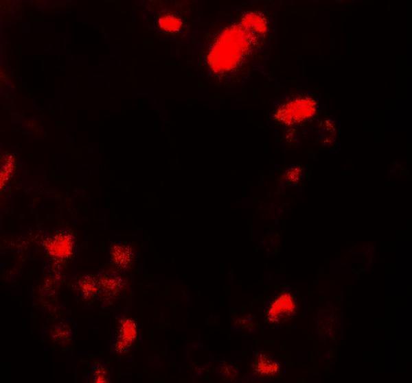 Immunofluorescence of UBIAD1 in mouse liver tissue with UBIAD1 antibody at 20 μg/mL