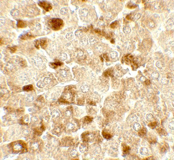 Immunohistochemistry of UBIAD1 in mouse liver tissue with UBIAD1 antibody at 5 μg/mL