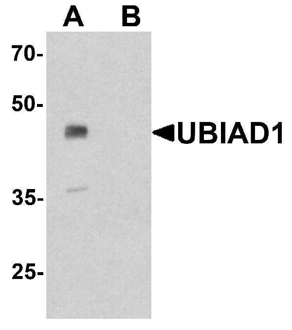 Western blot analysis of UBIAD1 in mouse liver tissue lysate with UBIAD1 antibody at 1 μg/ml in (A) the absence and (B) the presence of blocking peptide
