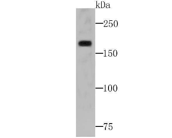 a04438 1 baz1b primary antiboties wb testing 1