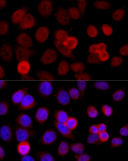 a04438 baz1b primary antiboties ihc testing 4