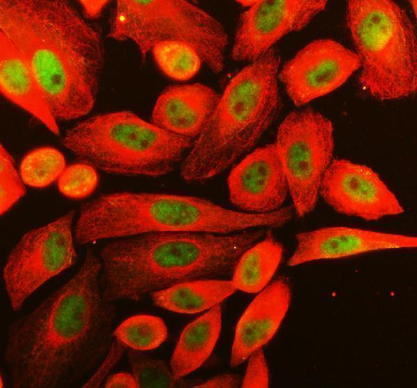 a04439 1 rbm10 primary antibodies if testing 1