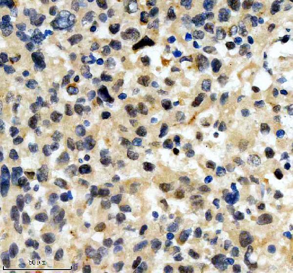 IHC analysis of RBM10 using anti-RBM10 antibody (A04439-1)