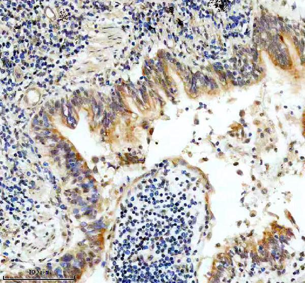 IHC analysis of RBM10 using anti-RBM10 antibody (A04439-1)