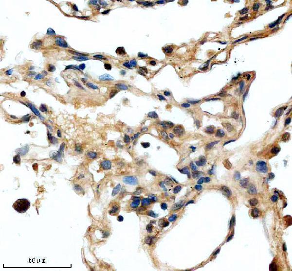 a04439 1 rbm10 primary antibodies ihc testing 3