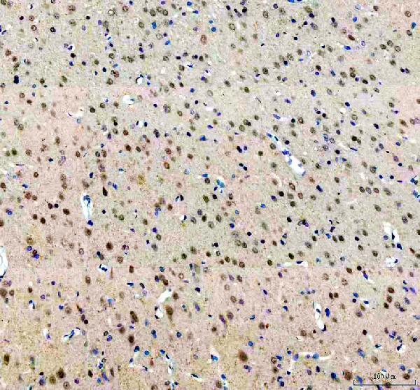 a04439 1 rbm10 primary antibodies ihc testing 4