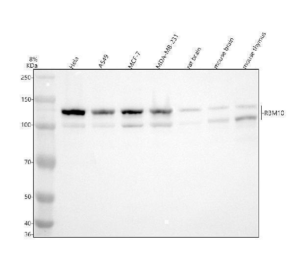 Western blot analysis of RBM10 using anti-RBM10 antibody (A04439-1)